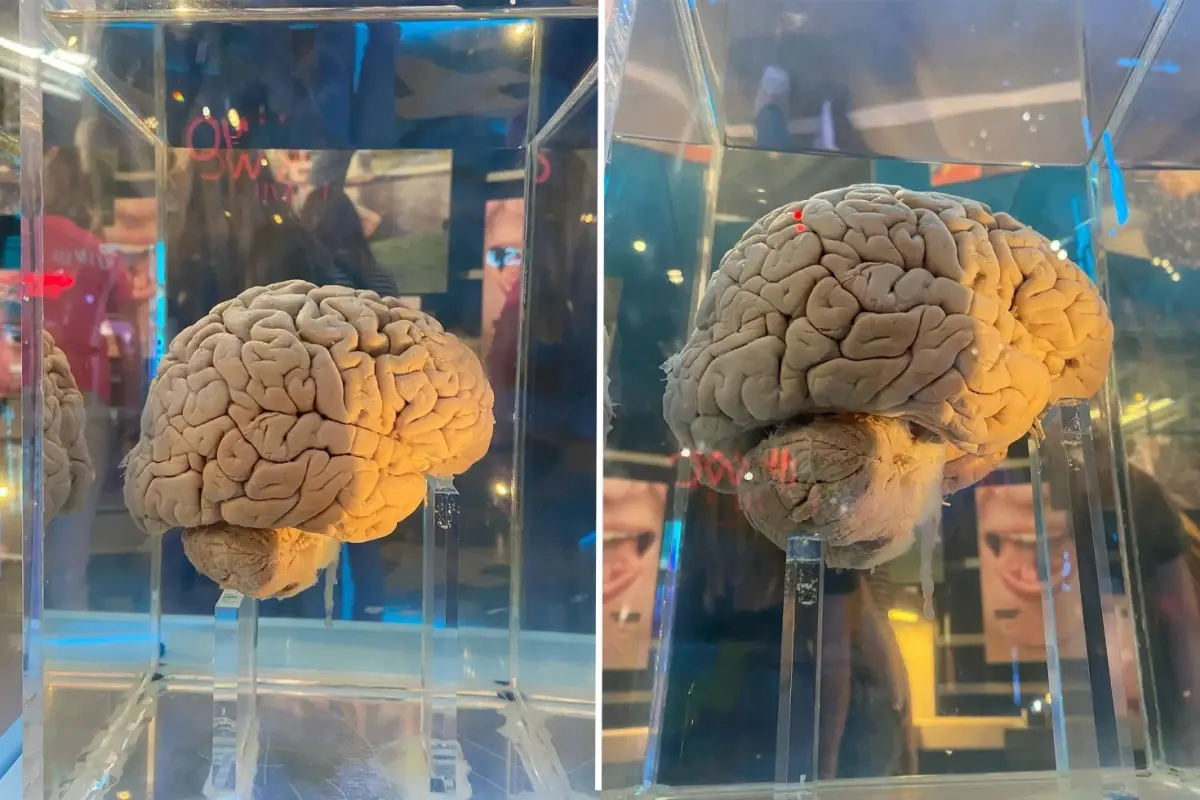 Amsterdam’da 5.300 Beyin, Yapay Zeka ile Moleküler Haritasına Çıkıyor