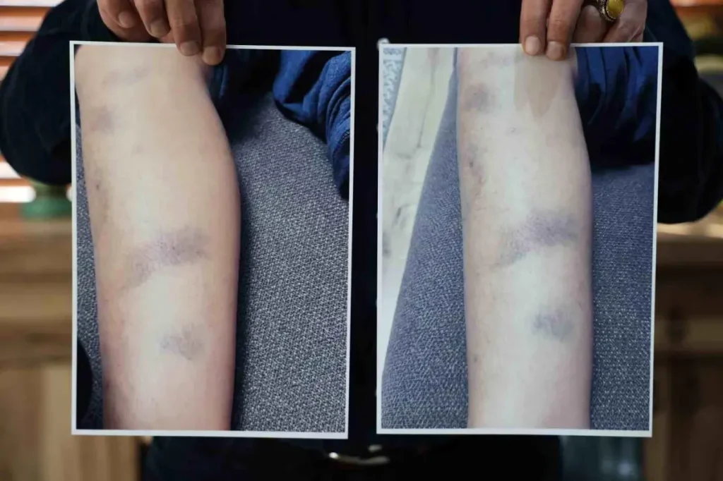 Diyarbakır’da Özel Okulda 8 Yaşındaki Çocuğa Yönelik Darp İddiası Gündemde