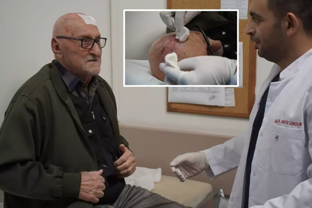 Dünyada iki örneği vardı, üçüncüsü Türkiye’de ortaya çıktı! Neredeyse ceviz büyüklüğünde