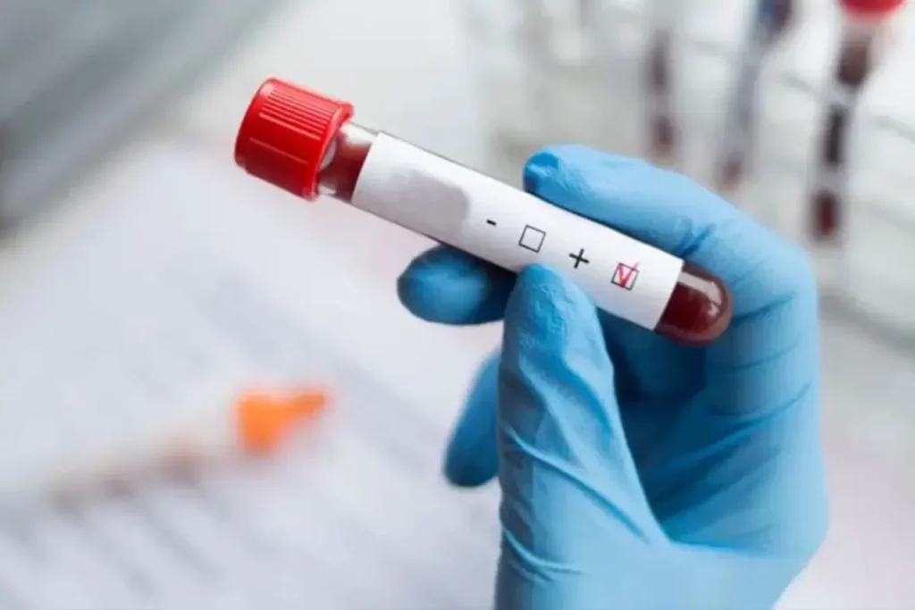 Dünyada HIV Vakaları Azalıyor, Türkiye’deki Artış Endişe Yaratıyor