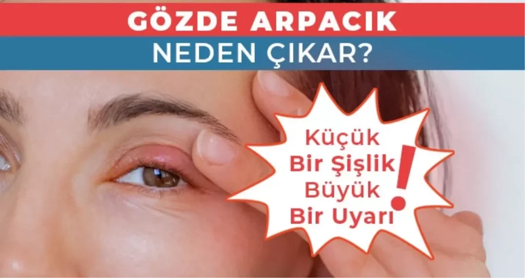 Gözde Arpacık Neden Çıkar? Küçük Bir Şişlik, Büyük Bir Uyarı