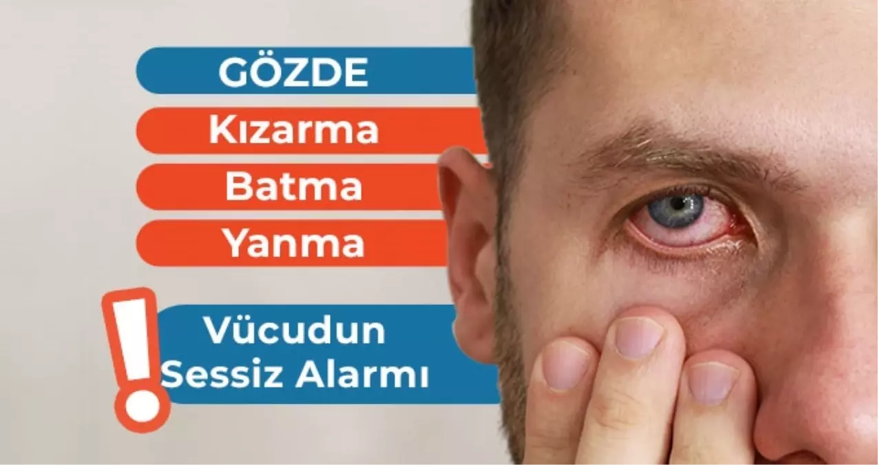 Gözde Kızarma, Batma ve Yanma: Vücudun Sessiz Alarmı