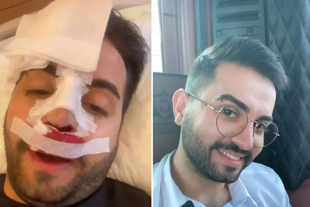 Kadir Ezildi burnu sargılı fotoğrafıyla korkuttu! Gerçek çoktan ortaya çıkmıştı