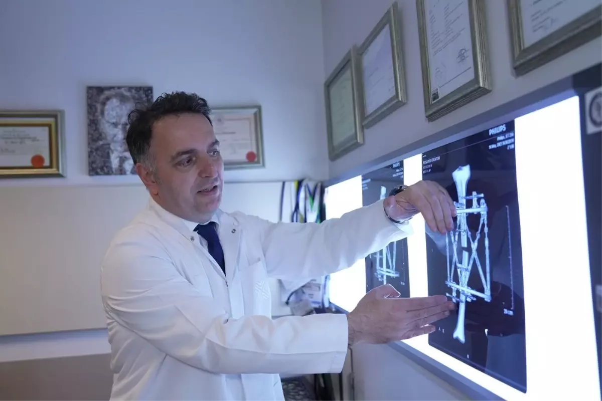 Kemik Uzatma Yöntemlerinde Yeni Dönem: Modern Teknolojiyle Daha Konforlu ve Güvenli Çözümler