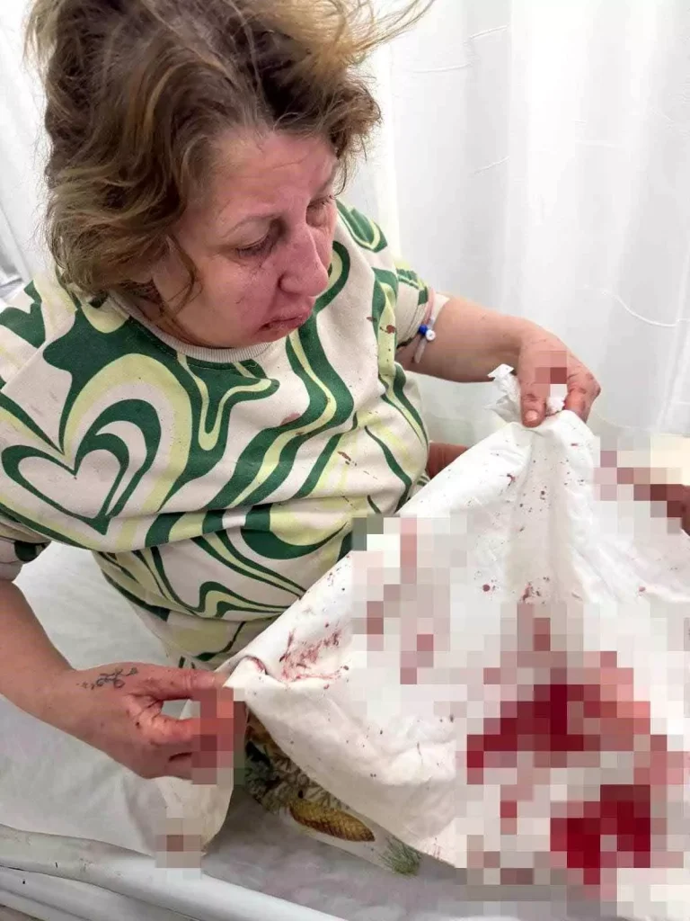 Denizli’de Gürültü Kavgası Şiddetle Bitti