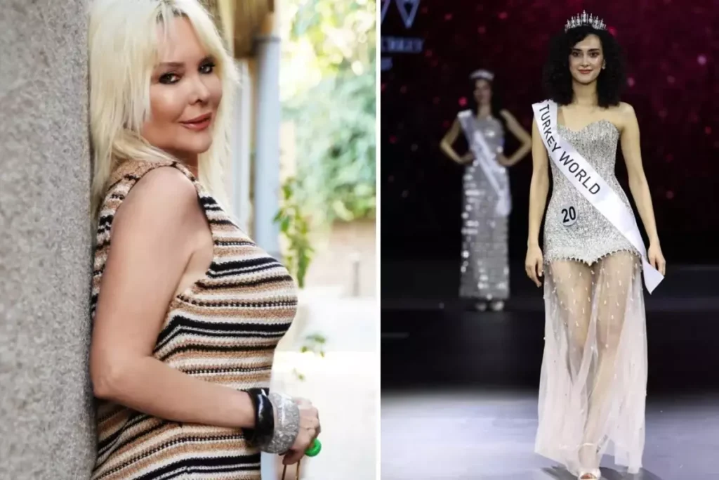 Özlem Savaş’tan Çok Konuşulacak Bacak Çıkışı! O Detayı İşaret Edip Sordu