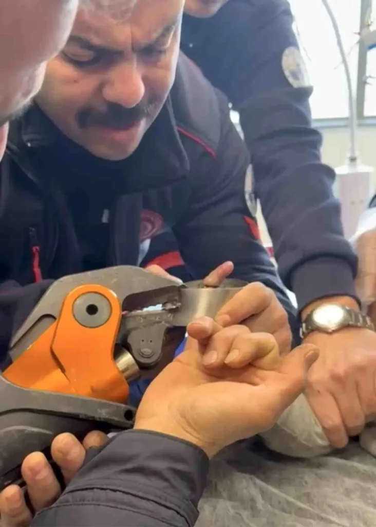 Bebeğin Sıkışan Parmağı İtfaiye Ekipleriyle Kurtarıldı