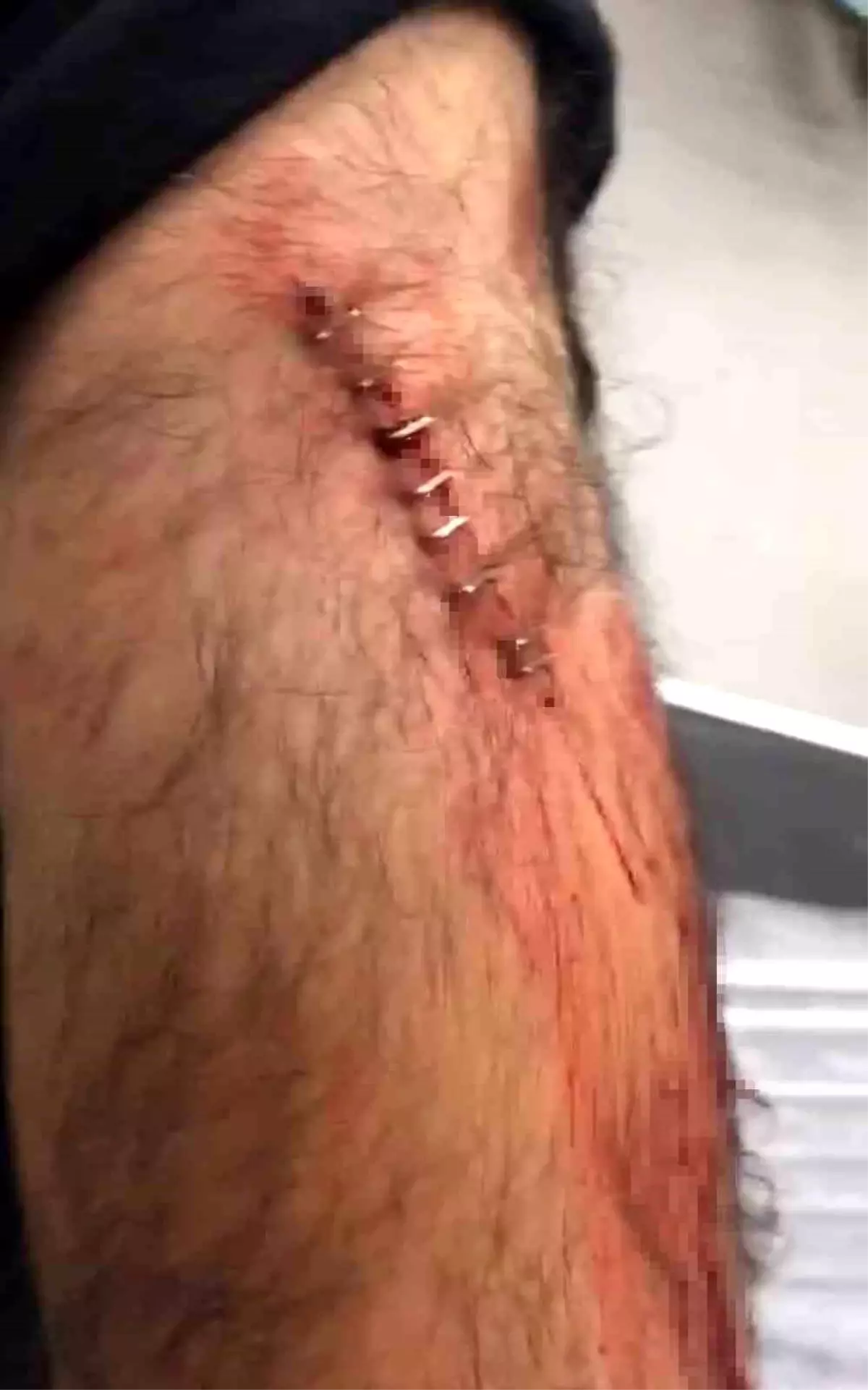 Öğretmene Jiletli Saldırı