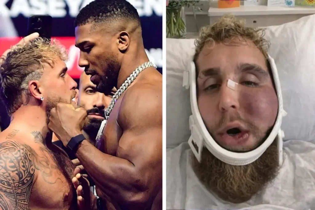 Suratı Tanınmaz Hale Gelen Jake Paul’un 92 Milyon Dolarlık Şok Kazancı!