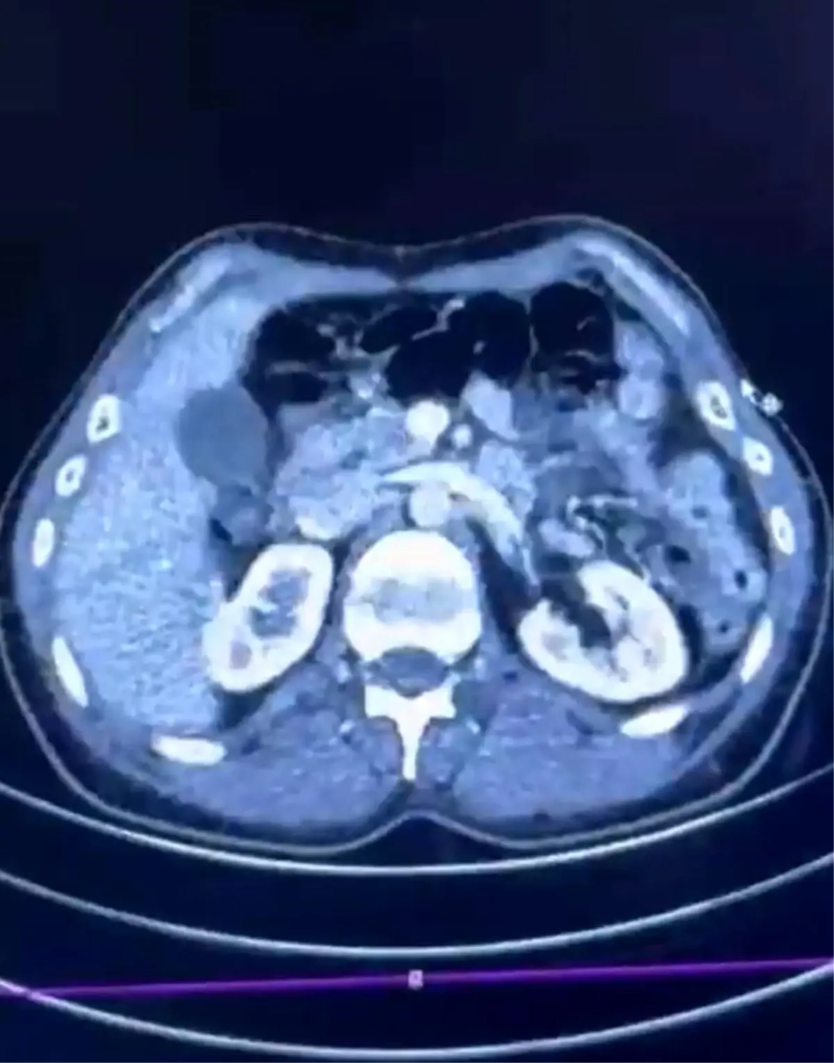 Kayseri’de Uyuşturucu Operasyonu: 554 Gram Ele Geçirildi